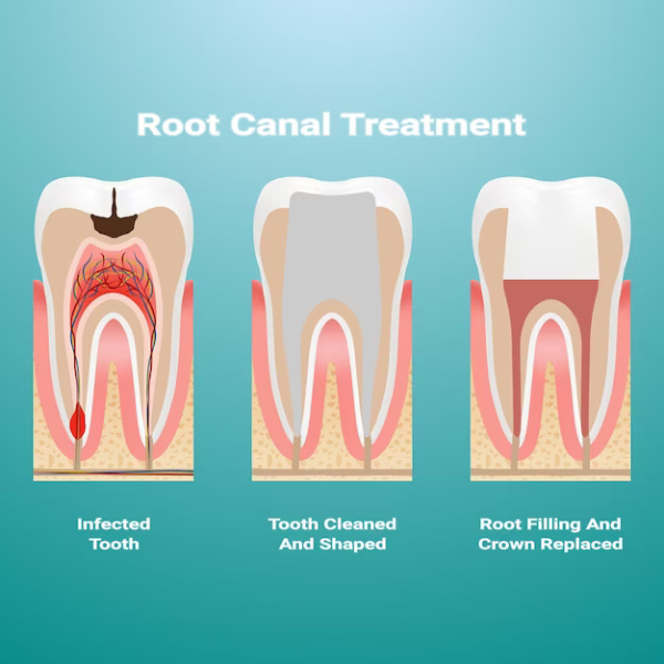 Cosmetic Dentistry In Pune