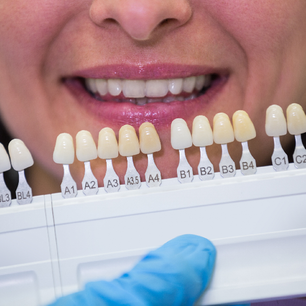 Root Canal Treatment Dentist In Pune